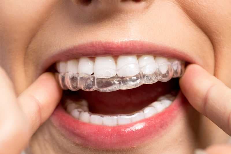 5 Prosedur Medis untuk Mengatasi Gigi yang Goyang