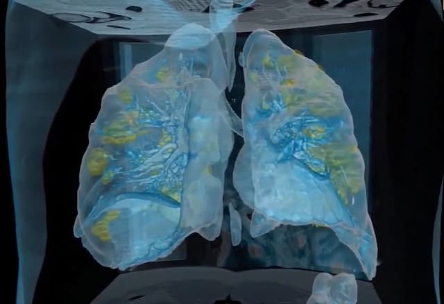 Melihat Virus Corona Memangsa Paru-paru Manusia Lewat VR
