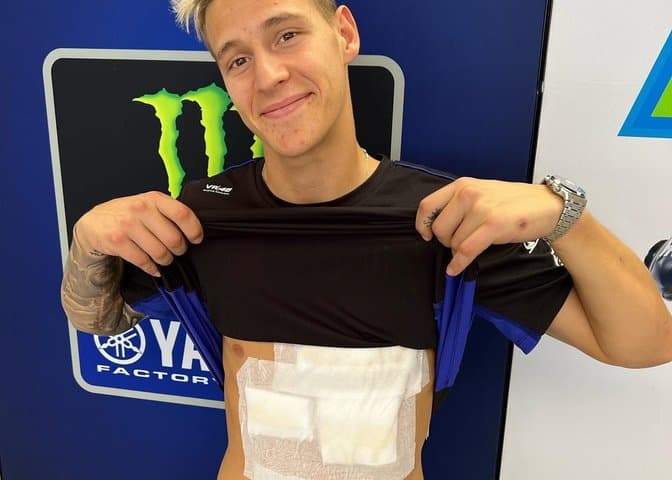 Usai Tabrak Marquez, Quartararo Tabrakan Lagi dengan Skuter Usai Tabrak Marquez, Quartararo Tabrakan Lagi dengan Skuter