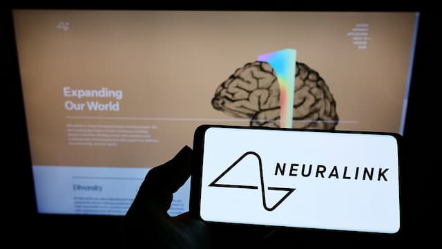 Proyek Gila Elon Musk Terwujud, Berhasil Tanam Chip ke Otak Manusia