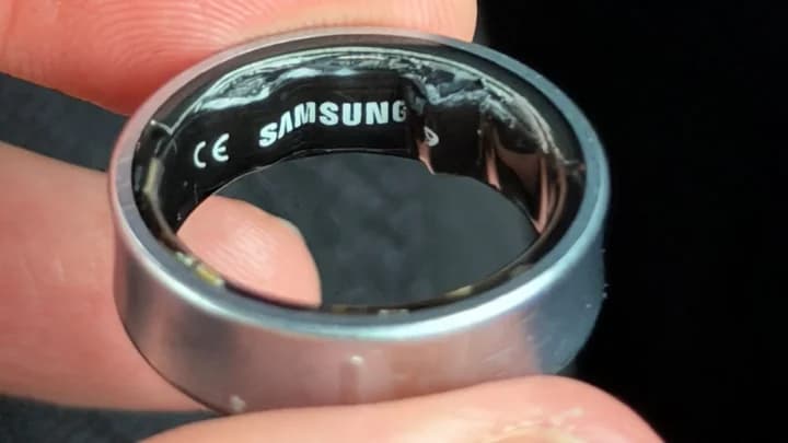 Bukannya Pantau Kesehatan, Galaxy Ring Malah Bikin Pengguna Masuk RS Bukannya Pantau Kesehatan, Galaxy Ring Malah Bikin Pengguna Masuk RS
