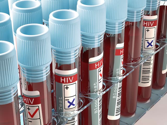 6 Cara Paling Efektif Mencegah Penularan HIV
