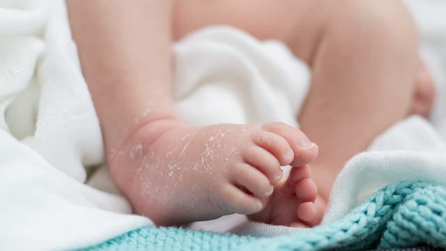 Kenapa Kulit Bayi Baru Lahir Mengelupas?